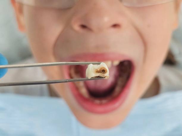Best Emergency Treatment for Toothache in Magnet Cove, AR