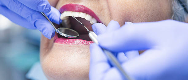 Best Emergency Wisdom Teeth Removal in Magnet Cove, AR